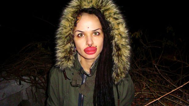 جثّتها مرمية في مجاري الصرف الصحي… إليكم تفاصيل وفاة مدونة روسيّة صاحبة أكبر شفتَين في العالم!