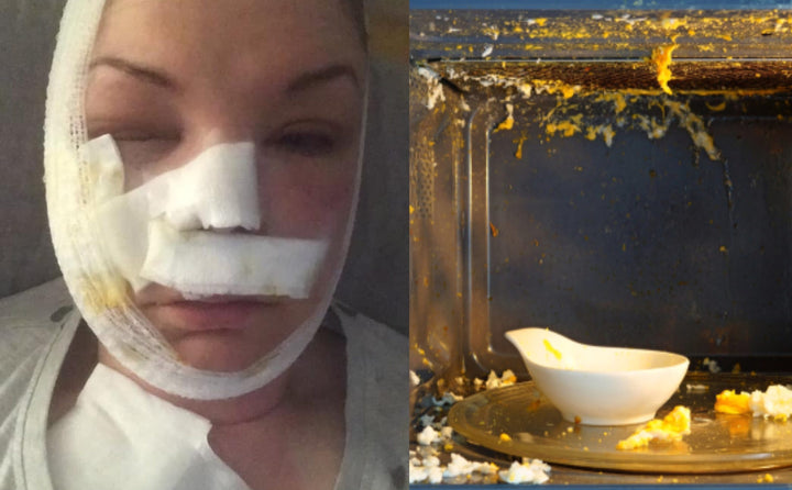 كارثة في وجه إمرأة بعد أن وضعت بيضة في الميكروويف!