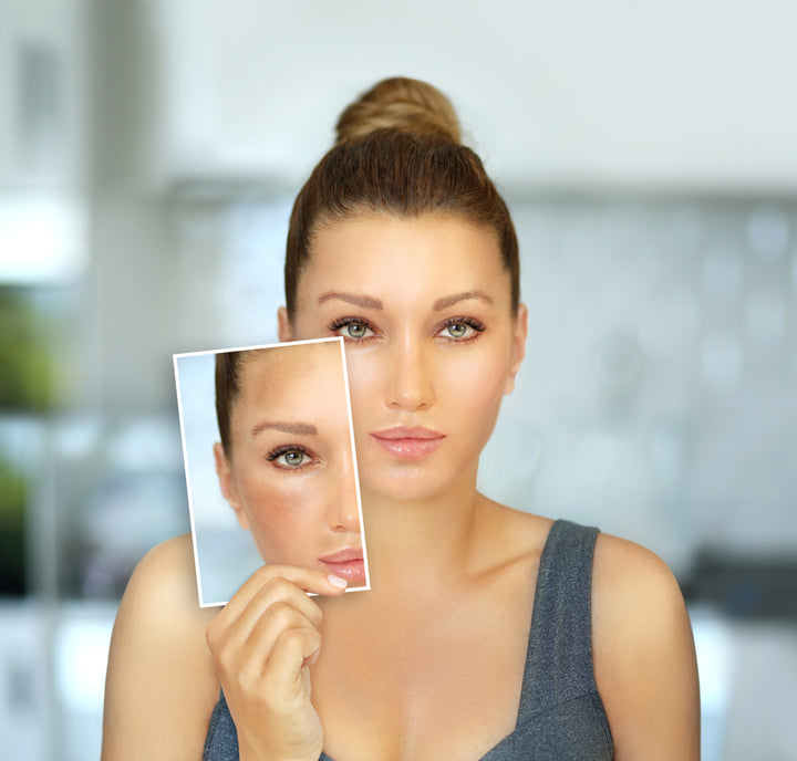 وصفات طبيعية سهلة التحضير لازالة البقع السوداء من الوجه