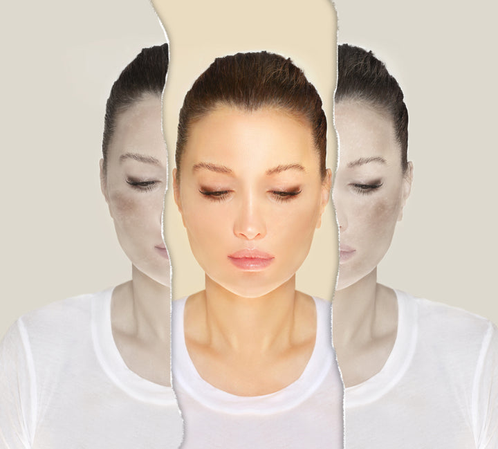 تبييض البشرة بين الطرق الطبيعية والتقنيات التجميلية مع د. أنطوان سلّوم