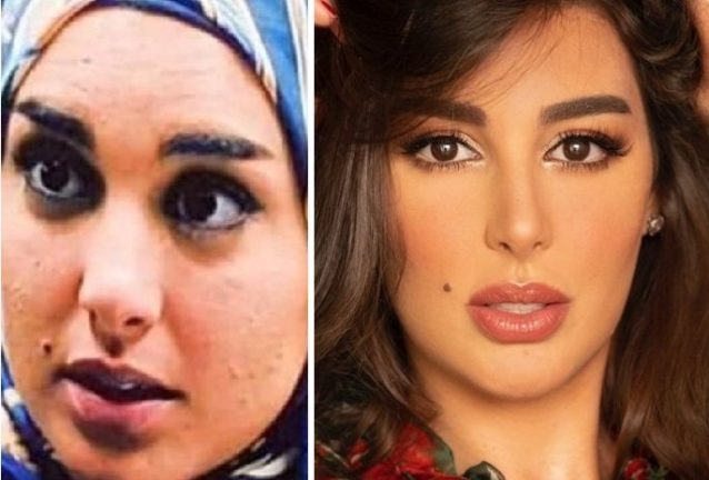 ياسمين صبري قبل عمليات التجميل هل تبدلت ملامحها وشكلها كثيراً أنوثة